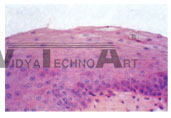 The slice of stratified pavement epithelium,W.M(cat esophagus,400x)